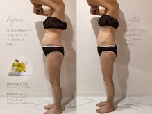 トータルエステサロン ポイント(POINT)の雰囲気（韓国発！レモンボトル♪高周波のマシーンでしっかり脂肪層撃退！）