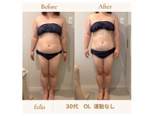エクリア(Eclia)の雰囲気(結果大重視/千葉/千葉中央/サイズダン/痩身/セル脂肪落ち)