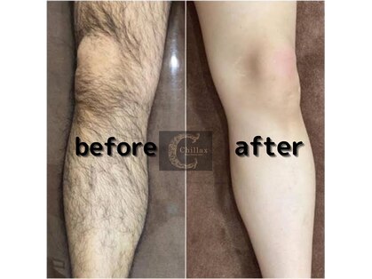 チラックス(Chillax)の写真