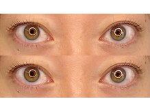 グラッド(GLAD)/ラッシュリフト