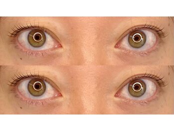 グラッド(GLAD)/ラッシュリフト