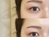 【 眉毛の左右差解消 】ハリウッドブロウリフト