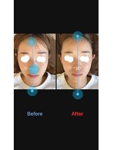 美容矯正サロン レレポノ(LELEPONO)/顔の歪み矯正、小顔施術