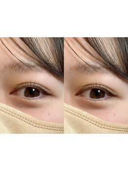 ナチュラル上品な目元にしたい