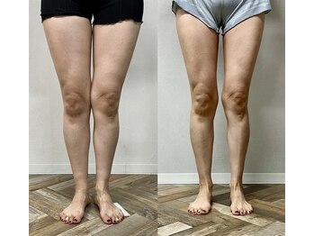 イイチェンジスタイル(iichangestyle)/全身エステの方の変化