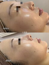 メイ 葛西(Mei)/初回で実感うる艶肌