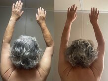 スーピー(SuuuPeee)/【筋膜リリース整体】