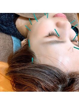 宇宿鍼灸整骨院/鍼灸【美容鍼】