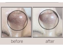 ハルハル(Haru Haru)の雰囲気（ごわつき/毛穴/黒ずみ/シワ/シミ/たるみの改善も得意！）