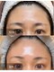 リベルテ(Liberte)の写真/肌質改善で、今よりもっと綺麗な素肌へ。毛穴・くすみなどのお悩みに寄り添い、理想の肌になれるサロン