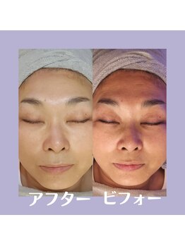 ルヴィオール バイ クニコ(L’VIOR BY Kuniko)/人気の水光肌