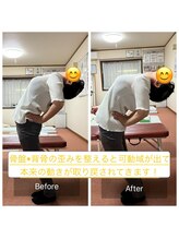 カルラ(KARURA)/可動制限は骨盤背骨の歪みが原因