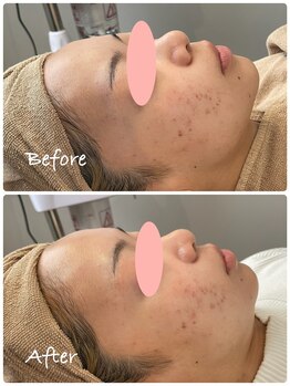 ロイ(Loy)/24/7/4のブログをご覧ください♪