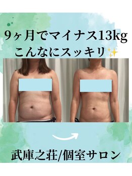 エデン(Eden)/痩身/ダイエット/ボディライン