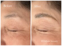 ヒビキノ バイ ヒビハンビューティー(hibikino by Hibihan Beauty)/ハリウッドブロウリフト
