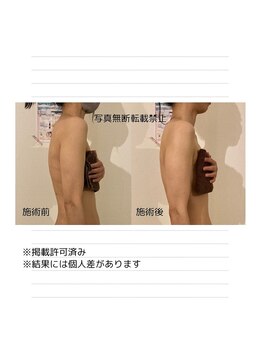 プラスフリー(Plus Free)/【巻き方・猫背】肩こり・首こり