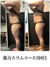 ピーラトゥ 日立(P-Ratu)/強力スリムコース