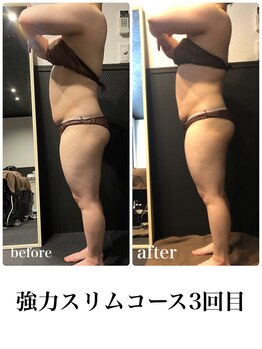ピーラトゥ 日立(P-Ratu)/強力スリムコース