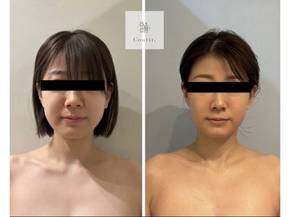 モアナ(Moana)の写真