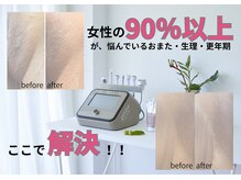 アール(ar.)