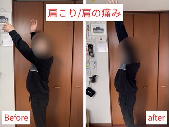 活法術 福岡整体院/肩の痛みに！！