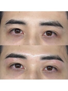 ブロウ(BROW)/【メンズ眉】before after