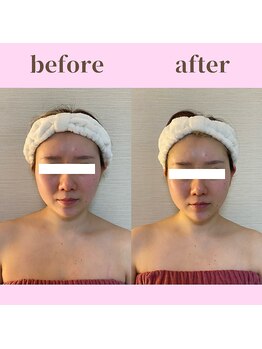 ココ(COCO)/お客様ビフォーアフター