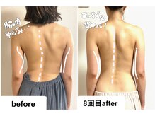 つばききよら/背中の歪みも変わる！脇肉も