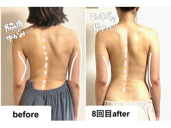 つばききよら/背中の歪みも変わる！脇肉も
