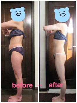 サンパティック(Sympatik)/【本気痩身！セル撃退ケア】