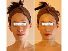 パル コルギサロン(Pal. Korugi salon)/コルギビフォーアフター