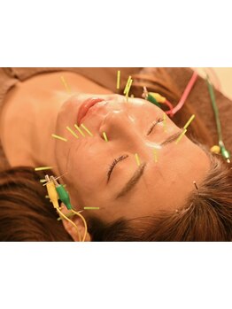 鍼灸施術を受けたい