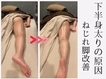 ツーアップ(2up)/一生痩せないねじれ脚1回