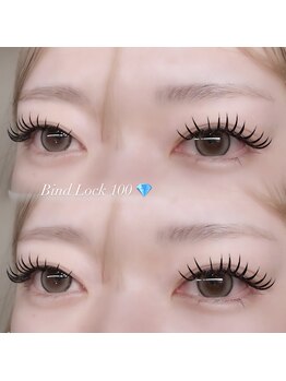 ベースメントアイスポット バイ ビュー(BaseMent eYe SPOT by V.I.E.W)/Bind Lock ★