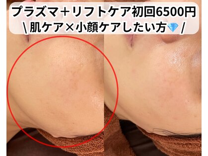 ベルファーム(Belle Femme)の写真