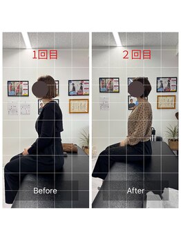 ナオル整体 鹿児島院(NAORU整体)/猫背矯正