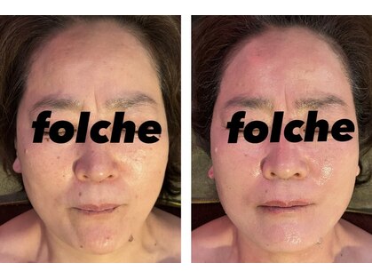 フォルチェ 己斐店(Folche)の写真