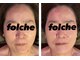 フォルチェ 己斐店(Folche)の写真