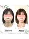 木の葉の写真/【実力派小顔専門店】「あれ？老けた？」疲れて見える顔、卒業しませんか？鏡を見るのが楽しみに♪