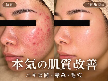 ハル(HARU.)の写真