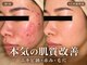 ハル(HARU.)の写真