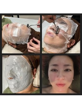 ステラマリス(STELLA MARIS)/フェイシャルケアで白玉肌整顔☆