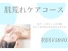 【肌荒れ/ニキビケア】フェイシャルコース　13200円→5980円