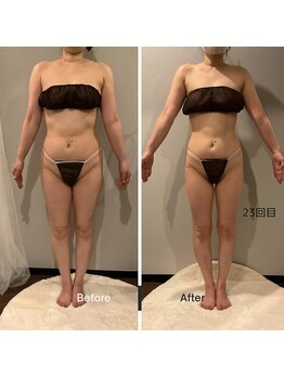 ソウソウビューティー 五反田(Shou Shou Beauty)/ビフォーアフター★23回目