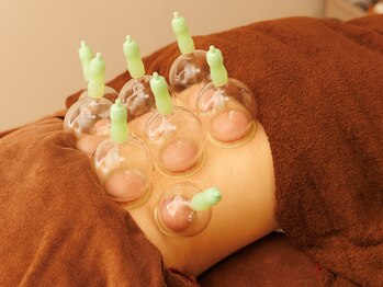 光幸はりきゅう院接骨院/症状に合わせた吸い玉☆浦和腰痛