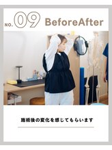 ラキピラティス かわたに接骨院(Lakipilates)/BeforeAfter