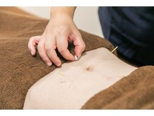 代官山アサ接骨院 鍼灸院(代官山 Asa 接骨院 鍼灸院)/胃腸の不調/自律神経の乱れ/血流