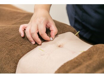 代官山アサ接骨院 鍼灸院(代官山 Asa 接骨院 鍼灸院)/胃腸の不調/自律神経の乱れ/血流