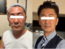 オニュ(onyu)/見た目年齢マイナス5kg！