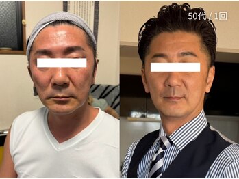 オニュ(onyu)/見た目年齢マイナス5kg！